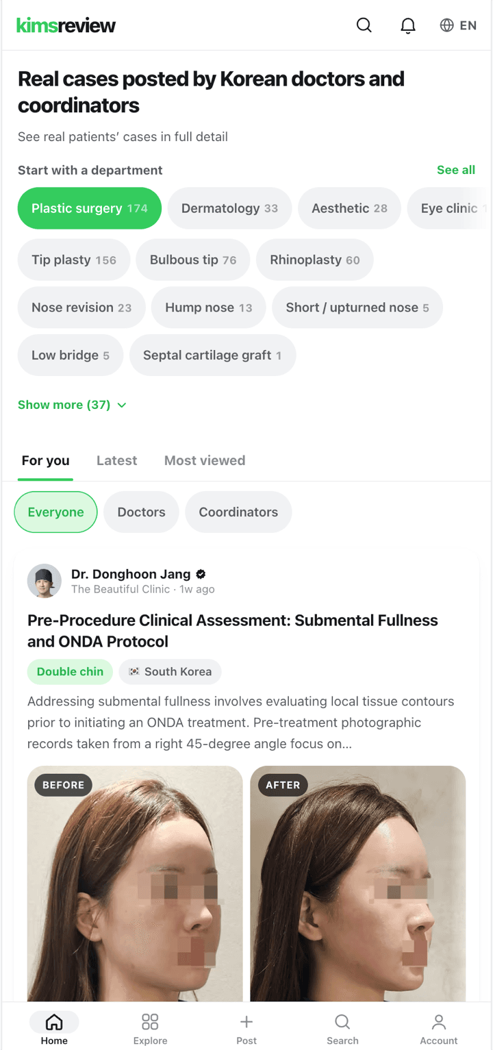 KimsReview 홈 — 한국 의사가 직접 올린 실제 시술 사례